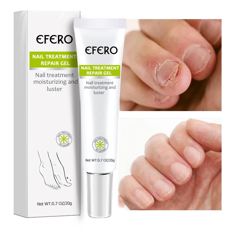 Nail Repair Gel – Nagelpflege, Anti-Pilz, Stärkung, Feuchtigkeit, Gesundes Wachstum