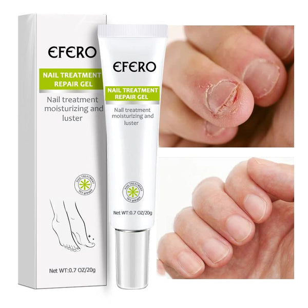 NailSavior™ - Nagelbehandlung Reparaturgel [1 + 1 Gratis]