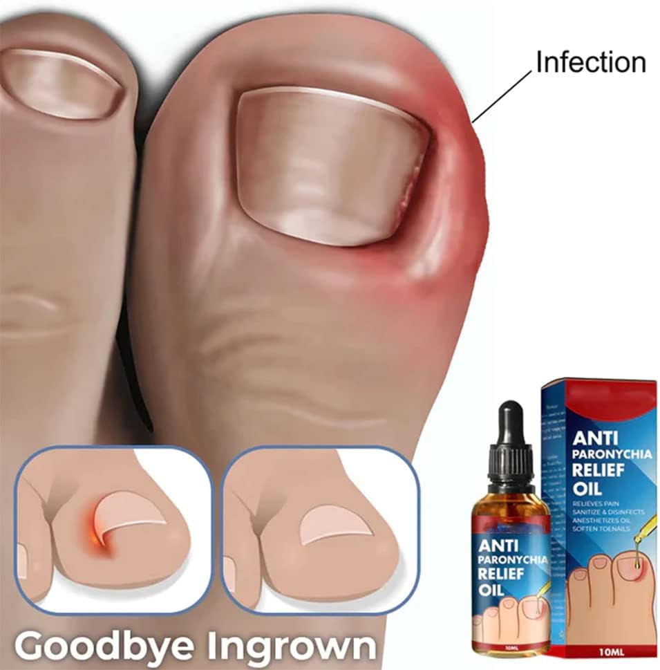 HealDrop™ – Repariert beschädigte, brüchige Nägel in nur 4 Wochen effektiv [1 + 1 Gratis]