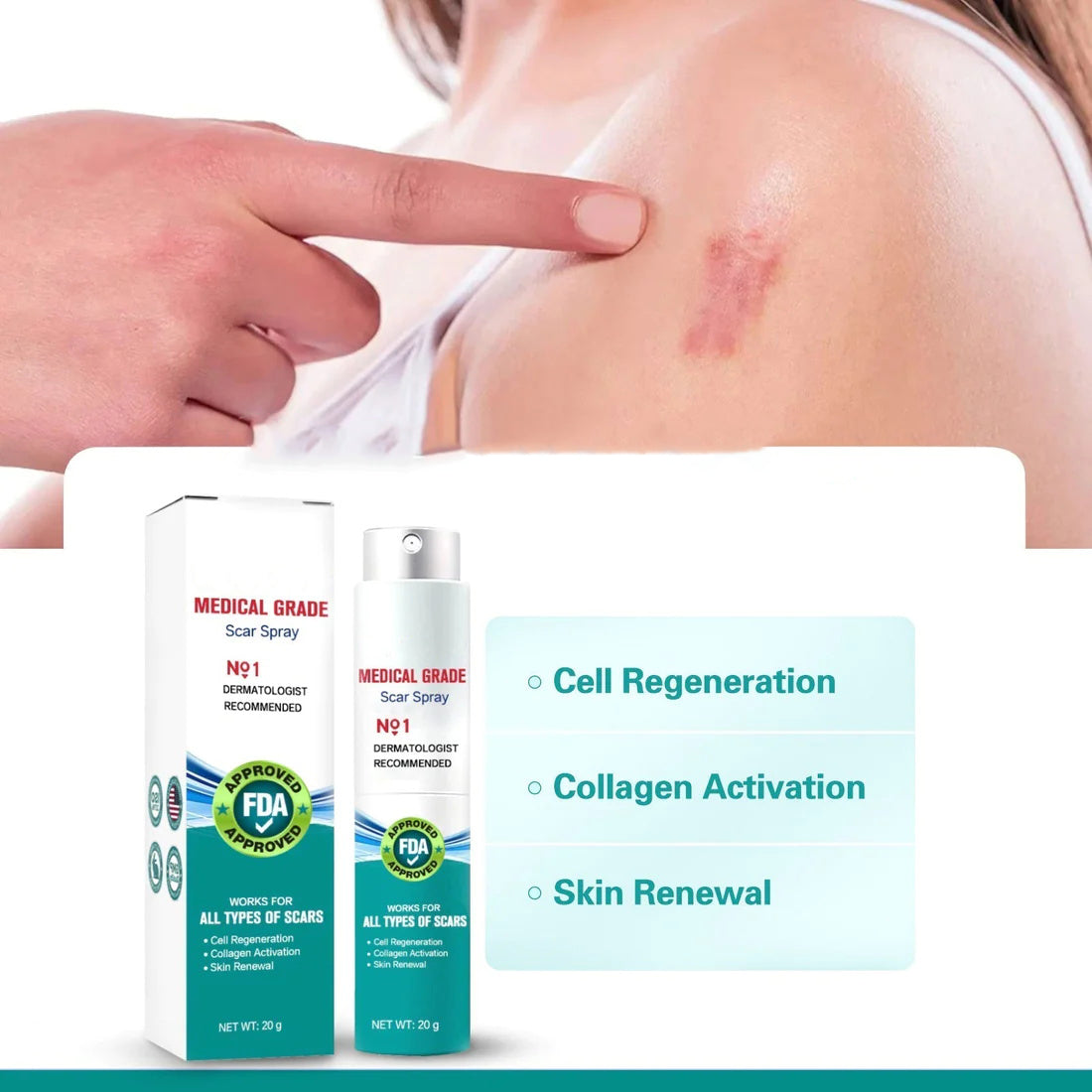 1+1 Gratis | ScarRemove™ - Schnellere narbenfreie Haut