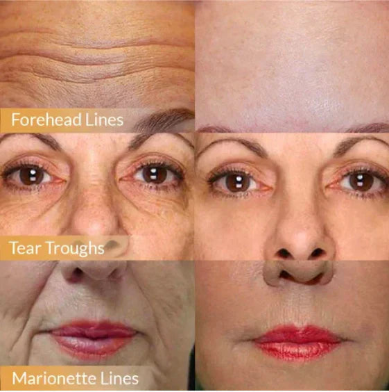 AntiAging™ – Lifting & Firming, feuchtigkeitsspendend mit Ginseng & Granatapfel [1 + 1 Gratis]