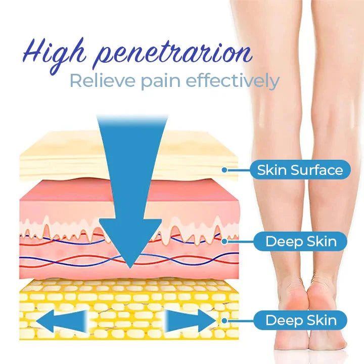 VariCose™ – Effektives Krampfader-Spray für schnelle Linderung und gesunde Beine [1 + 1 Gratis]