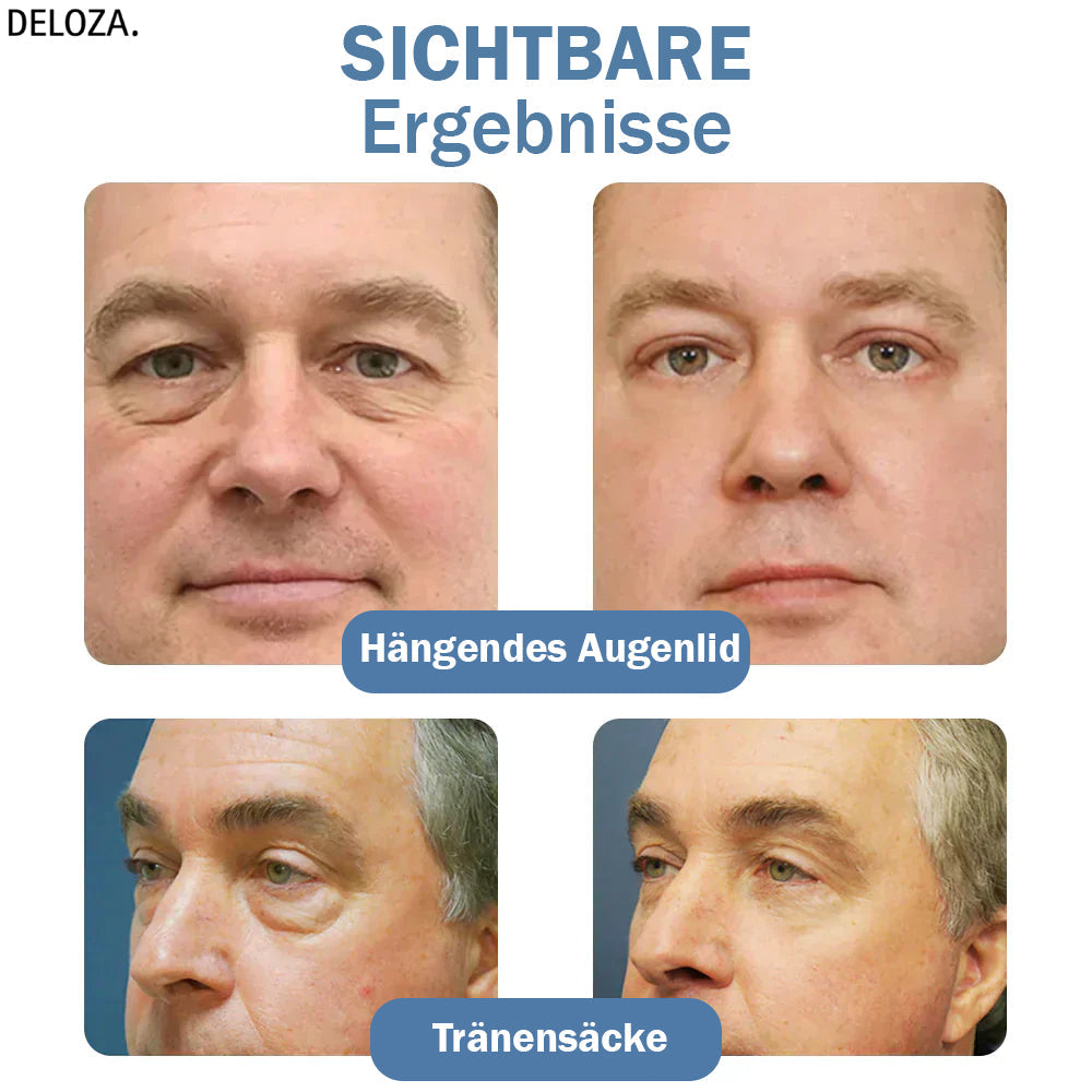 EyeRenew™ – Strahlende & jugendlich frische Augenpflege-Erneuerung [1 + 1 Gratis]