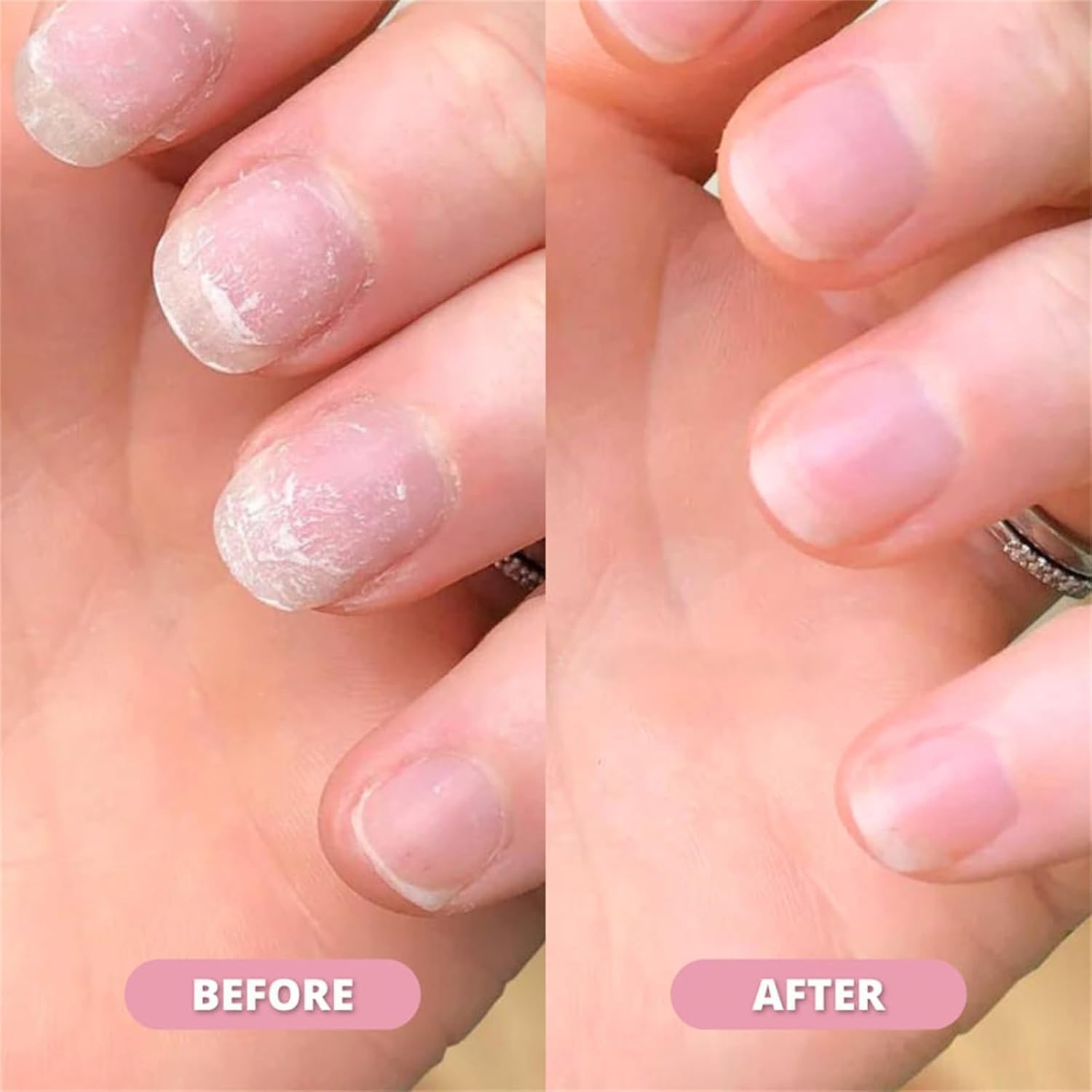 NailShine™ – Feuchtigkeitsspendend & stärkend, mit Vitamin E, C & B7 für gesunde, glänzende Nägel [50% Rabatt]