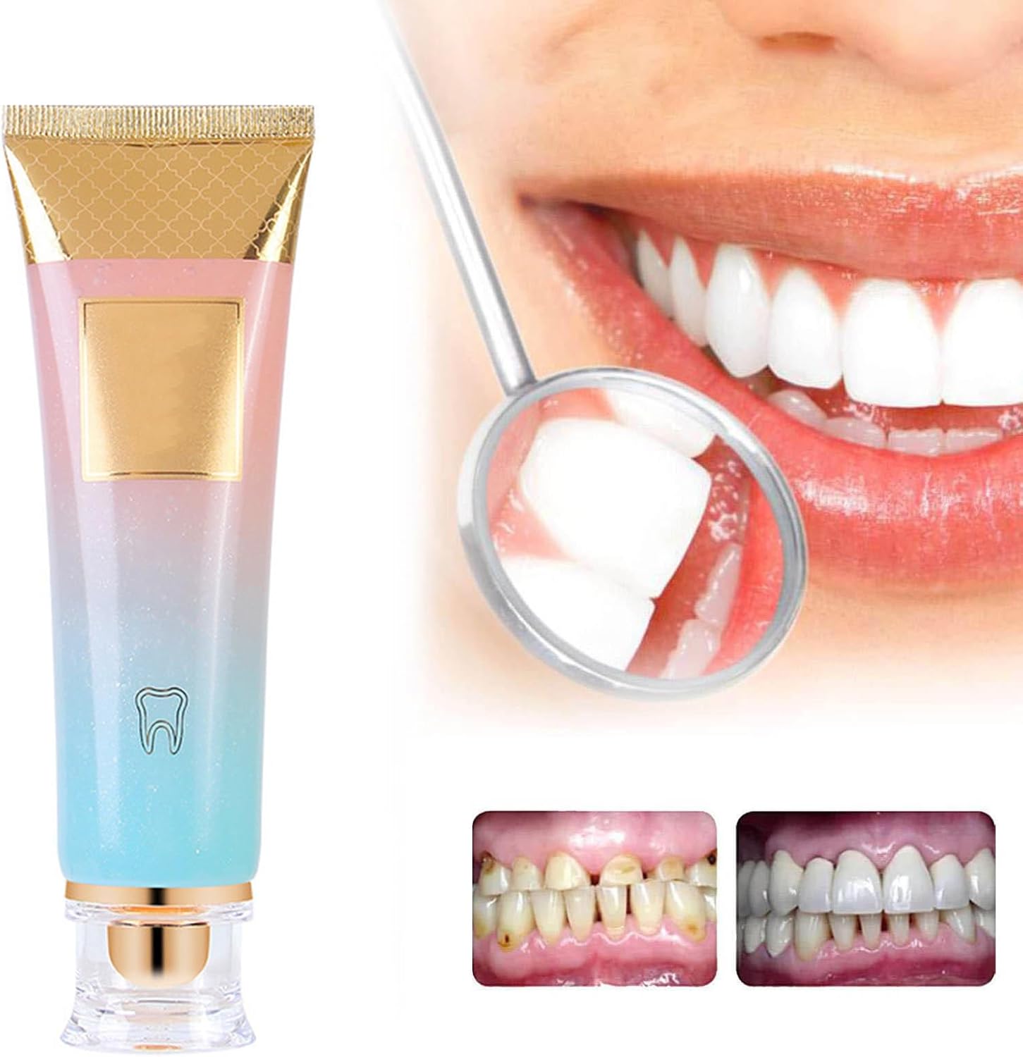 BrightSmile™ – Strahlend weiße Zähne ohne Empfindlichkeit [1 + 1 Gratis]