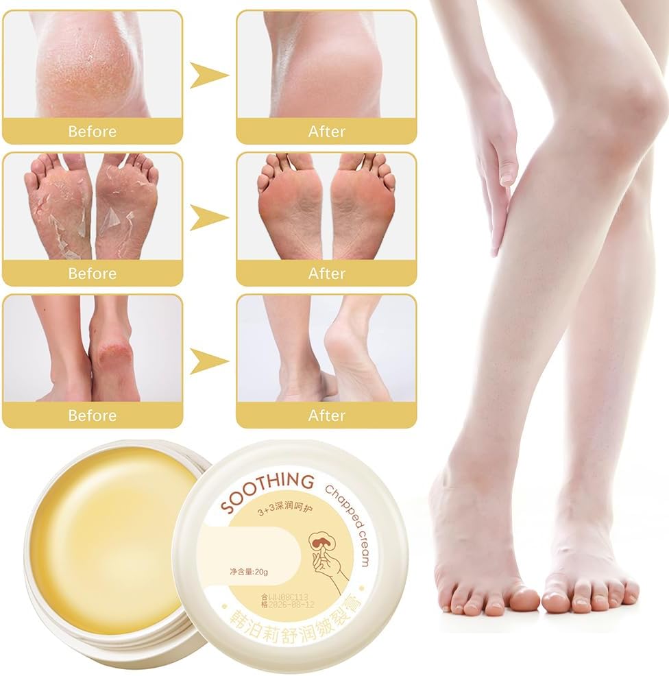 SkinShiner™ – Intensive Pflege für trockene Haut zur Reparatur und Regeneration [1 + 1 Gratis]