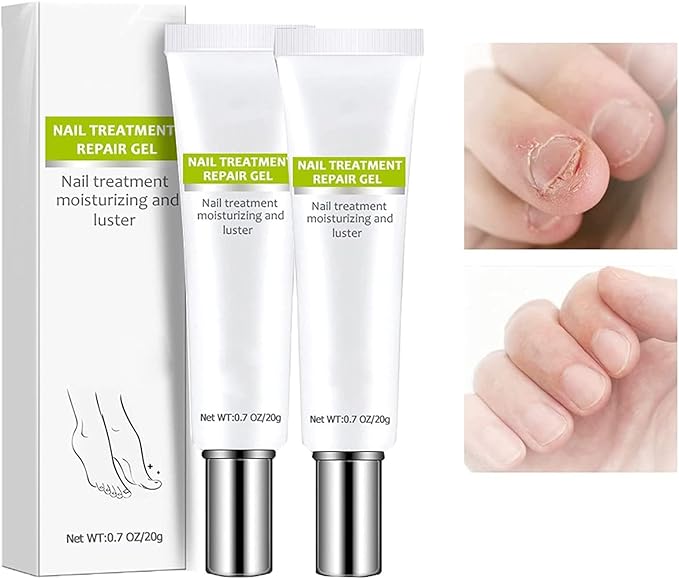 RejuveNail™ – Stärkt deine Nägel für ein gesundes & schönes Aussehen [1 + 1 Gratis]