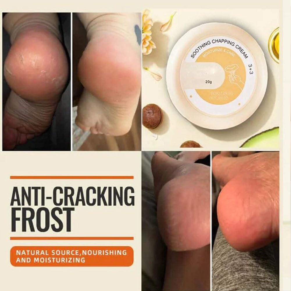 SkinShiner™ – Intensive Pflege für trockene Haut zur Reparatur und Regeneration [1 + 1 Gratis]