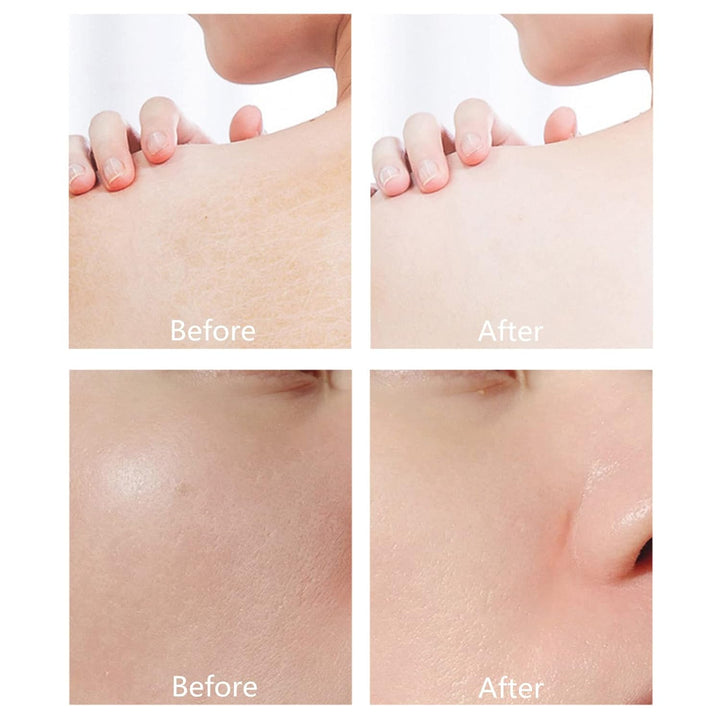 Derol™ – Für jugendlichen Glow-Boost und strahlende, gesunde Haut [1 + 1 Gratis]