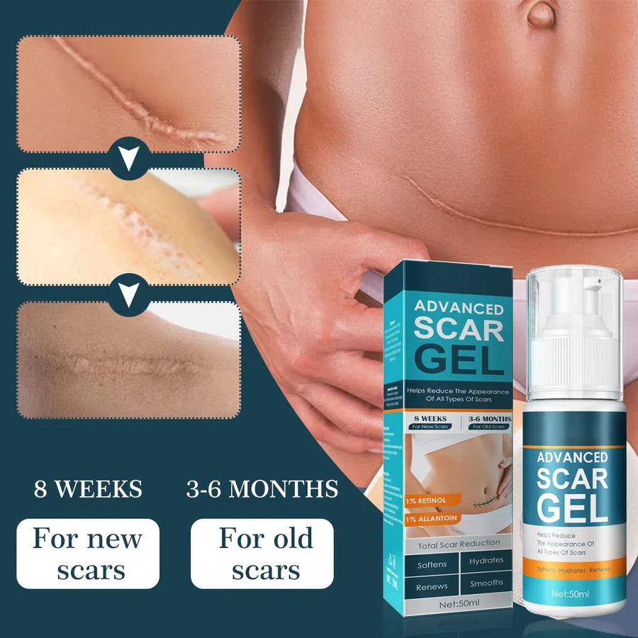 ScarAway™ – Fortschrittliches Gel zur Narbenentfernung für Glatte Haut | 1 + 1 Gratis