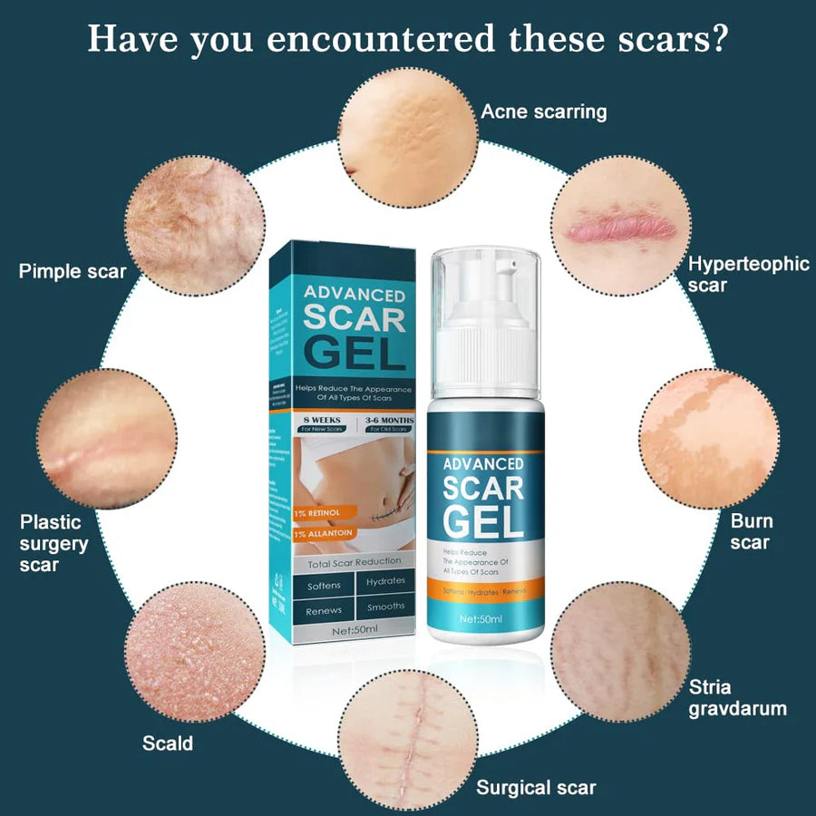 ScarAway™ – Fortschrittliches Gel zur Narbenentfernung für Glatte Haut | 1 + 1 Gratis