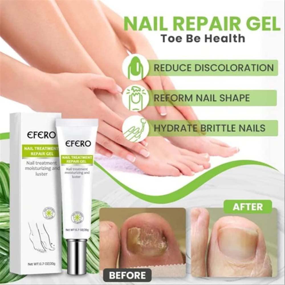 RejuveNail™ – Stärkt nachhaltig gesunde, schöne Nägel [1 + 1 Gratis]