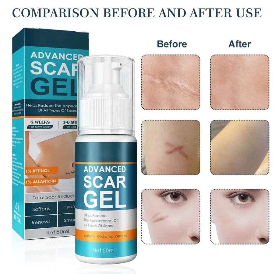 ScarAway™ – Fortschrittliches Gel zur Narbenentfernung für Glatte Haut | 1 + 1 Gratis