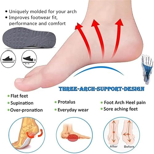 Linda™ – Orthopädische, bequeme, stilvolle und unterstützende Schuhe [50% Rabatt]