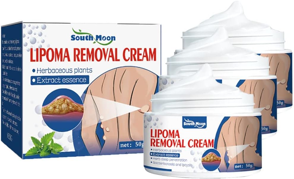 LipoGone Lipom Creme – Schmerzfrei, Natürlich, Entzündungshemmend, Effektiv, Hautpflege