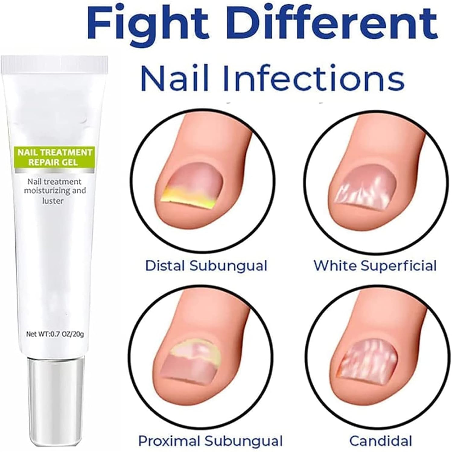 RejuveNail™ – Stärkt deine Nägel für ein gesundes & schönes Aussehen [1 + 1 Gratis]