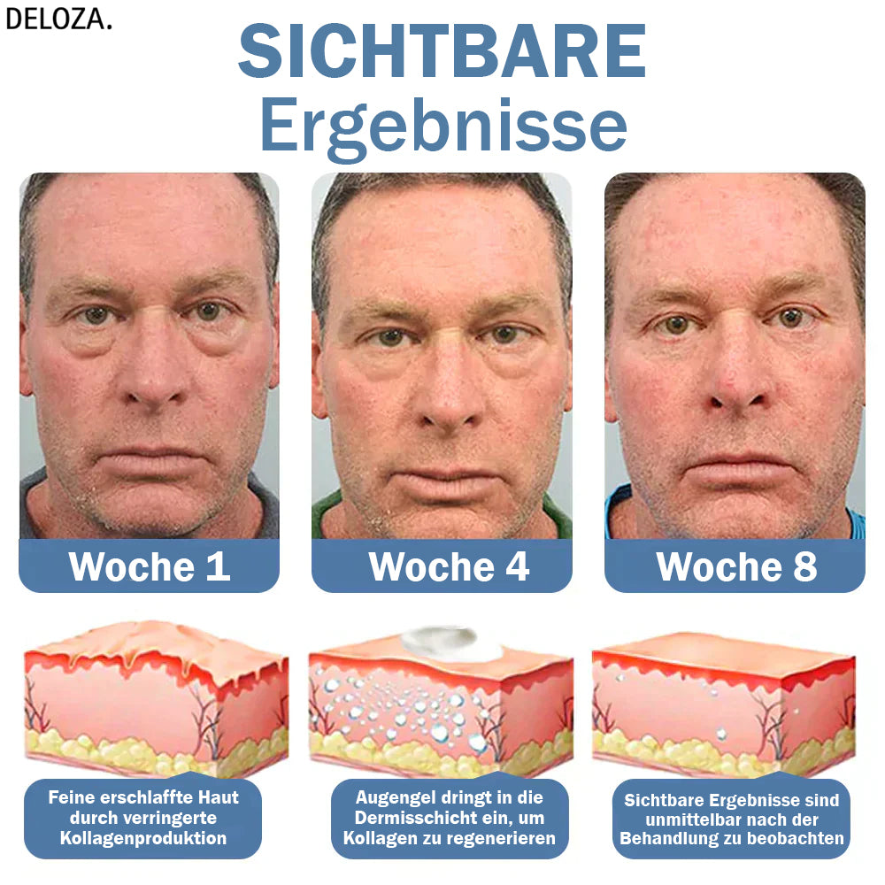 1 + 1 Gratis | OpenEyes™ - Verjüngendes Augen-Lifting-Gel für Männer und Frauen