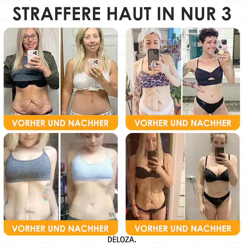 VenomCream™ – Straffende Anti-Aging-Creme mit Bienengift-Peptiden [1 + 1 Gratis]
