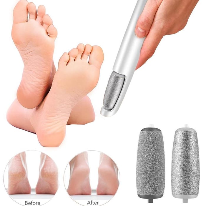 50% Rabatt | Pedicure™ - Elektrischer Hornhautentferner für seidig glatte Füße und Selbstvertrauen
