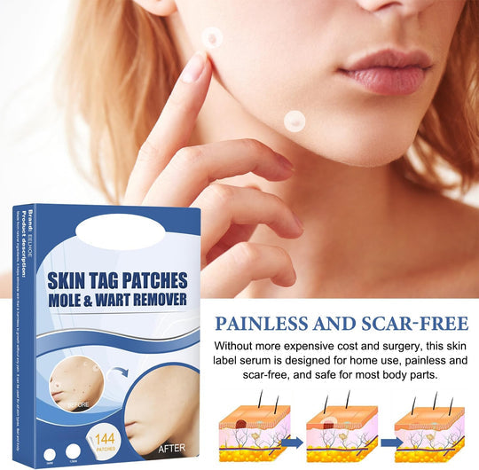 SkinPatch™ – Schmerzfreie, nicht-invasive Behandlung für sichtbar klare, gesunde Haut [1 + 1 Gratis]