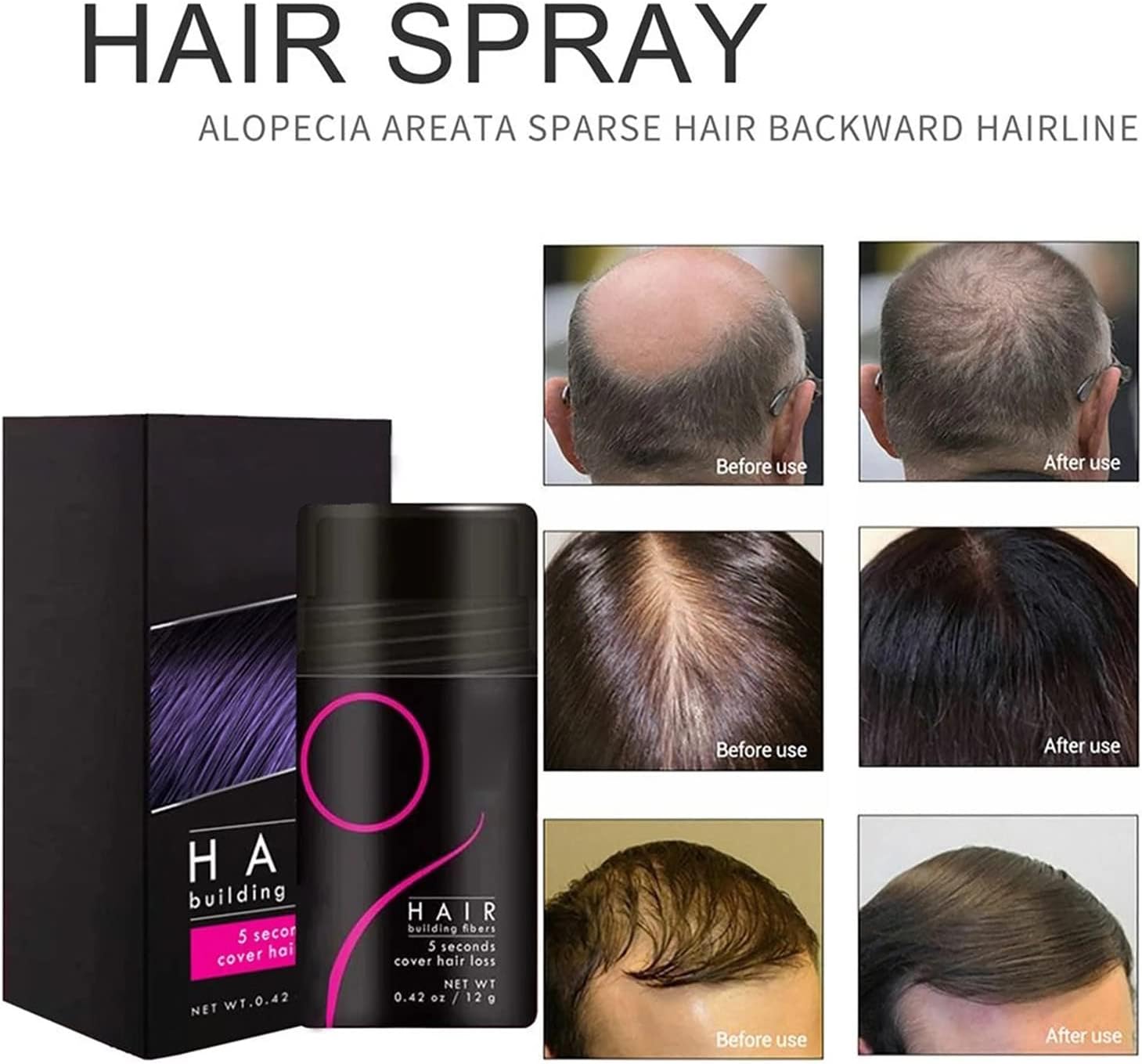 FluffUp™ – Sofortige Kahlheitskorrektur für volleres, natürliches Haar [50% Rabatt]