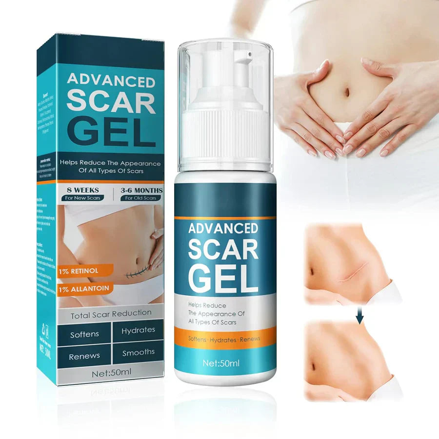 ScarGel™ -  Narben schön verblassen lassen [1 + 1 Gratis]
