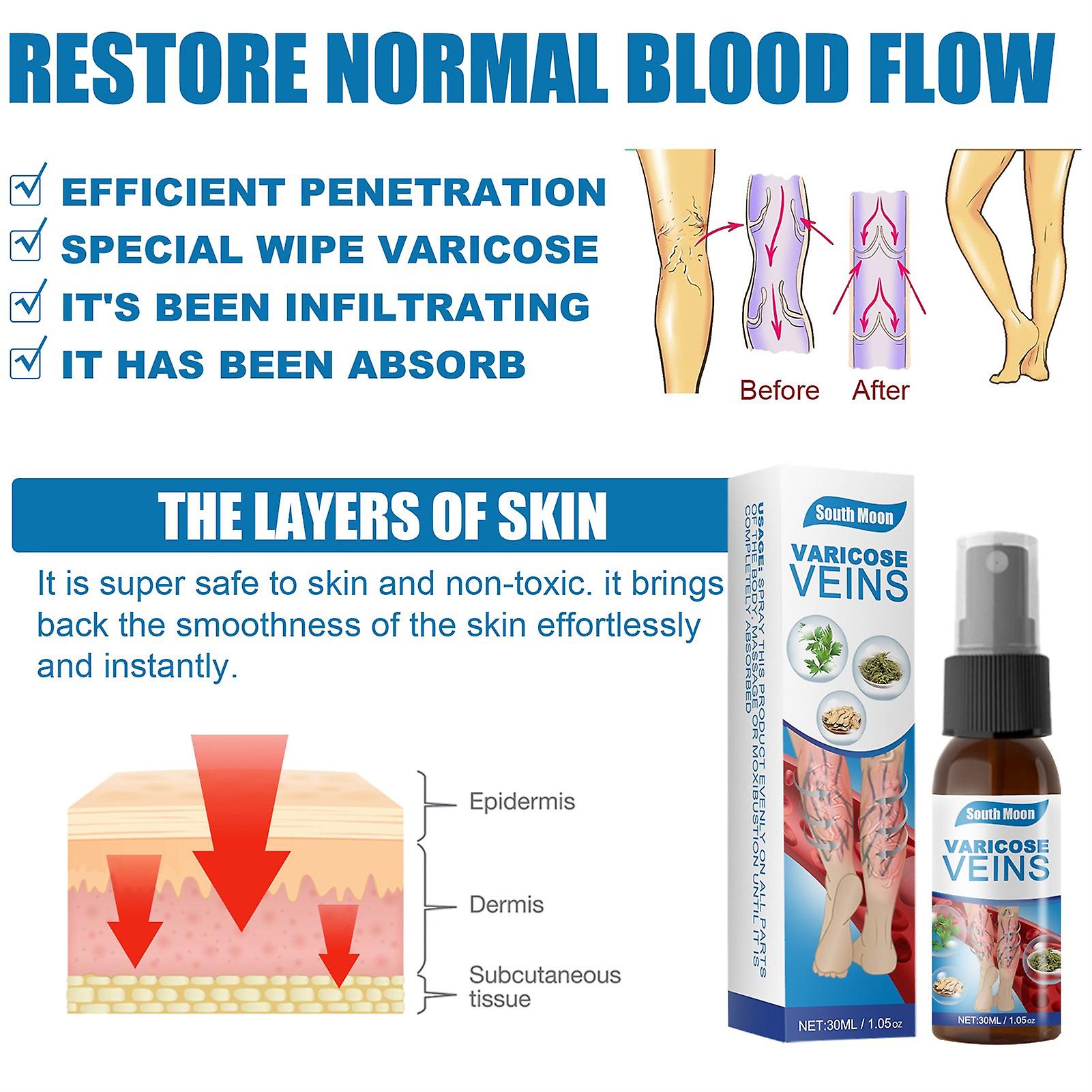 VeinSpray™ - Krampfadern ohne Operation behandeln! [1 + 1 Gratis]