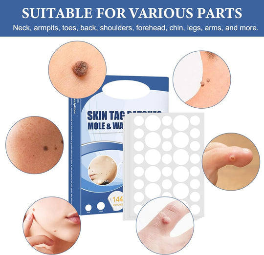 SkinPatch™ – Schmerzfreie, nicht-invasive Behandlung für sichtbar klare, gesunde Haut [1 + 1 Gratis]