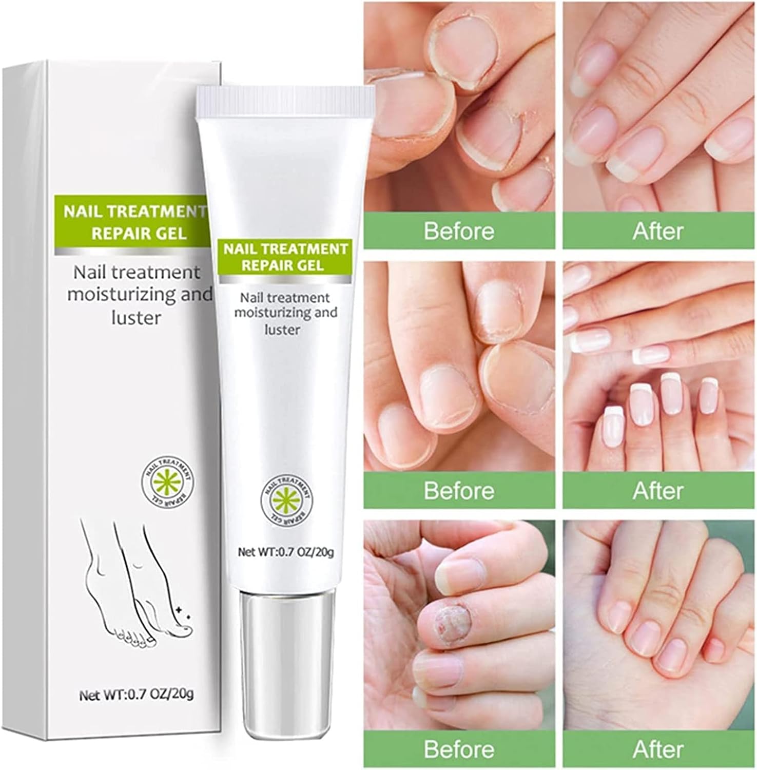 RejuveNail™ – Stärkt deine Nägel für ein gesundes & schönes Aussehen [1 + 1 Gratis]