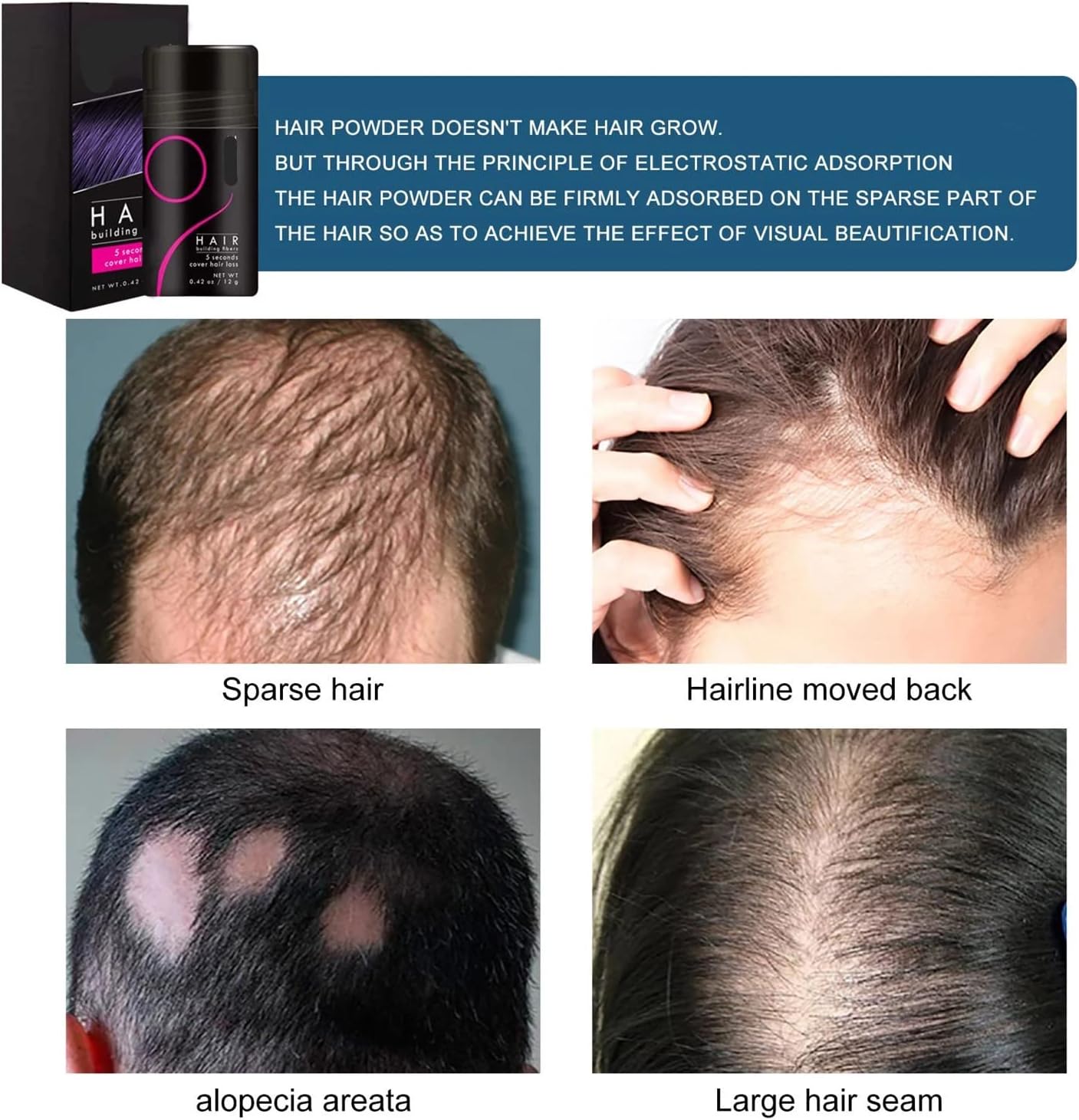 FluffUp™ – Sofortige Kahlheitskorrektur für volles, natürliches und gesundes Haar [50% Rabatt]