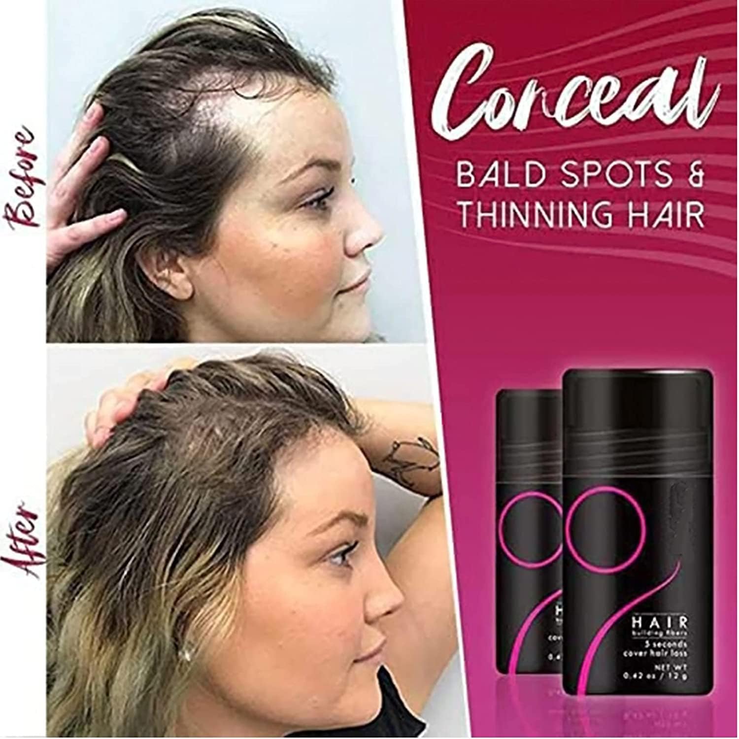 FluffUp™ – Sofortige Kahlheitskorrektur für volleres, natürliches Haar [50% Rabatt]