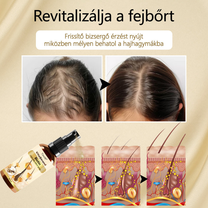 Timilk™ – VitaStrand Biotin Spray zur Förderung des Haarwachstums für dichtes, glänzendes Haar [1 + 1 Gratis]