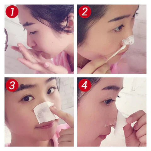 ClearSkin Porenstrips – Mitesser, Aktivkohle, Reinigung, Aloe Vera, Hautpflege, Klarer Teint