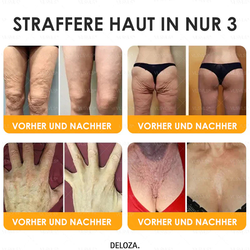 VenomCream™ – Straffende Anti-Aging-Creme mit Bienengift-Peptiden [1 + 1 Gratis]
