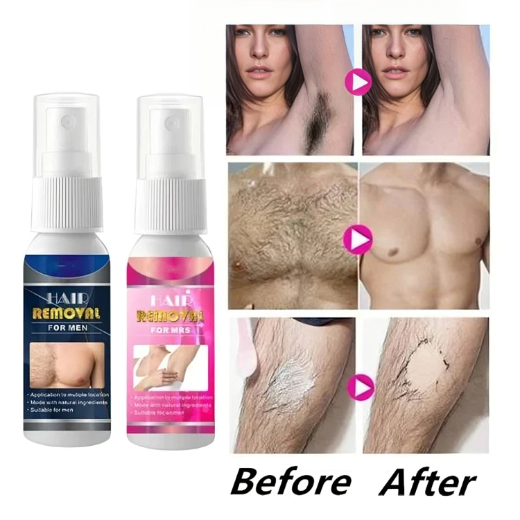 FreshBare™ – Schmerzfreie Haarentfernung für seidige, gesunde & glatte Haut [1 + 1 Gratis]