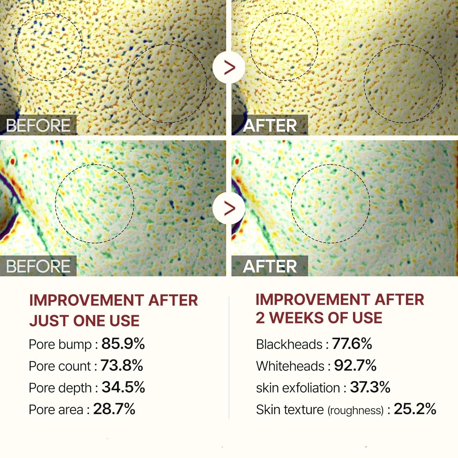 Gesichtspeeling™ – Sanfte Reinigung ohne Reizungen, entfernt Ablagerungen sofort effektiv [50% Rabatt]