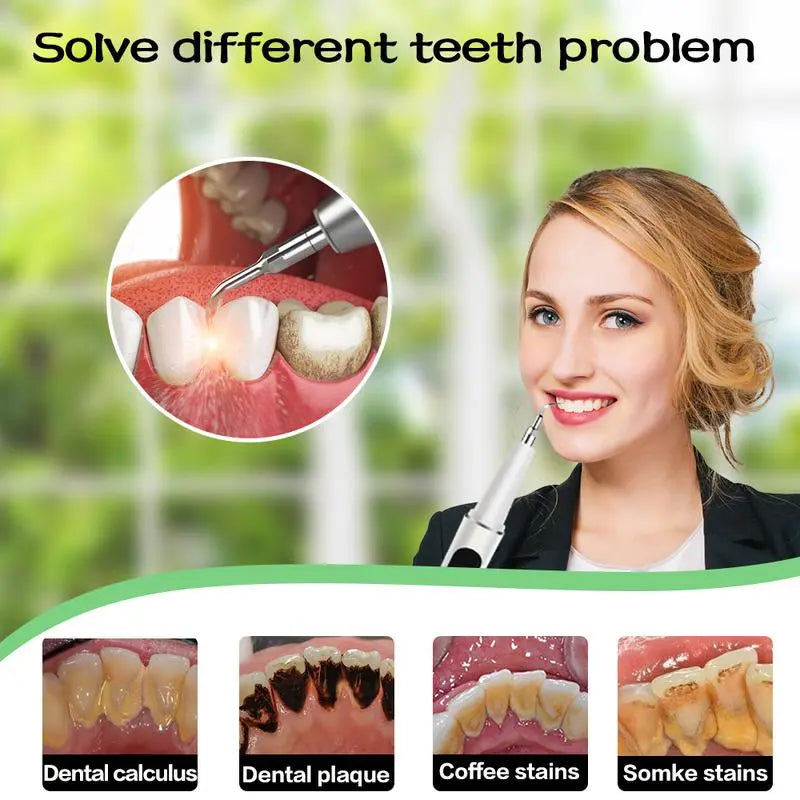 ProClean™ – Zahnreiniger Ultraschall, beseitigt effektiv Kaffee- & Rauchverfärbungen [50% Rabatt]