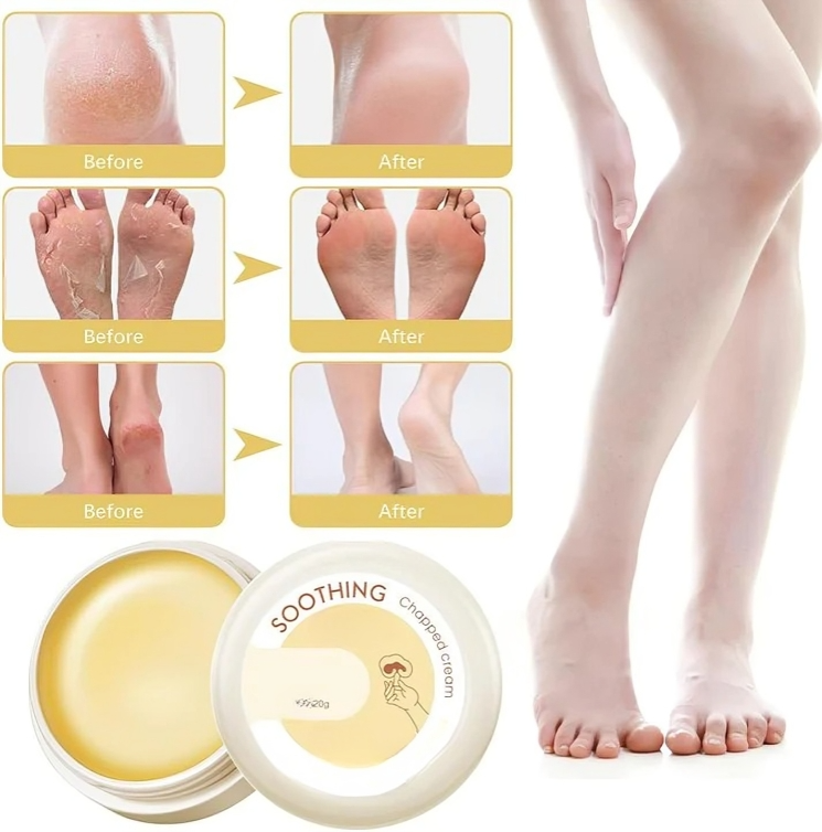 HydraHeel™ – Pflegende und beruhigende Creme für die tägliche Linderung [1 + 2 Gratis]