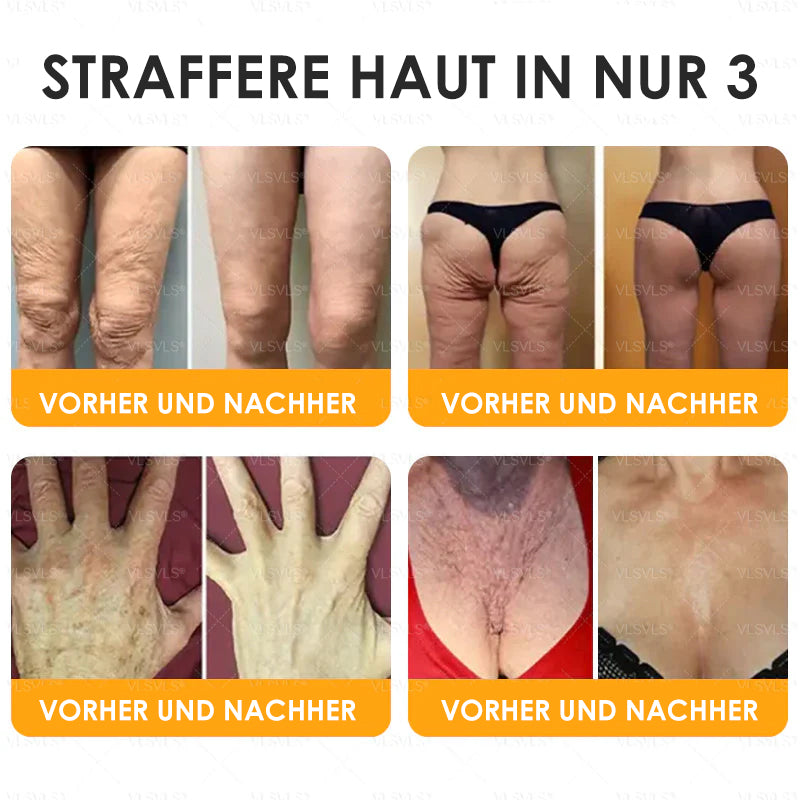 HealSkin™ – Straffende Anti-Aging-Creme mit Bienengift-Peptiden [1 + 1 Gratis]