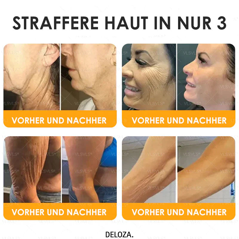 VenomCream™ – Straffende Anti-Aging-Creme mit Bienengift-Peptiden [1 + 1 Gratis]