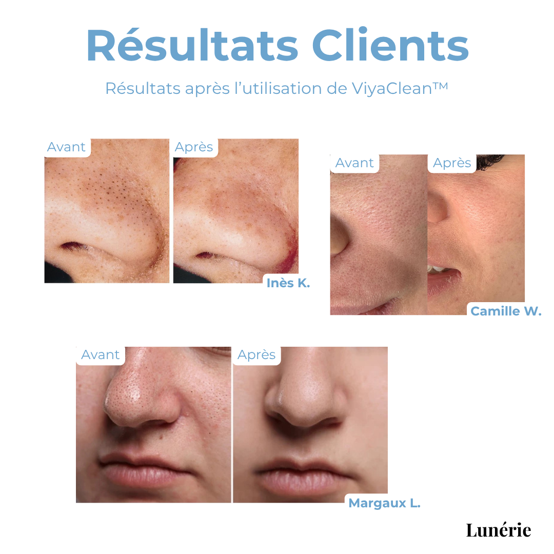 SkinClear™ – Porentiefer Reinigungs-Serum mit Salicylsäure & natürlichen Extrakten [50% Rabatt]