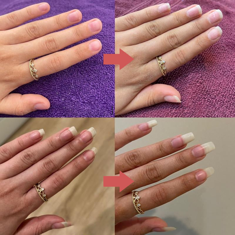 NailGrowth™ – Feuchtigkeitsspendende & stärkende Formel mit Vitamin E & Biotin, 5 g [50% Rabatt]