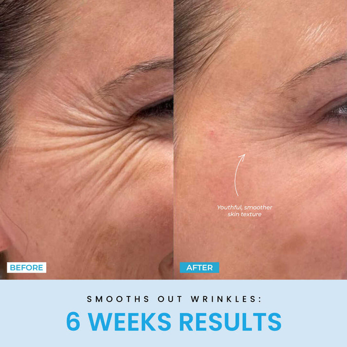 ContourVive EMS Gesichtsstraffungsgerät – Kieferlinie, LED-Therapie, Hautlifting, Anti-Aging, Mikrostrom