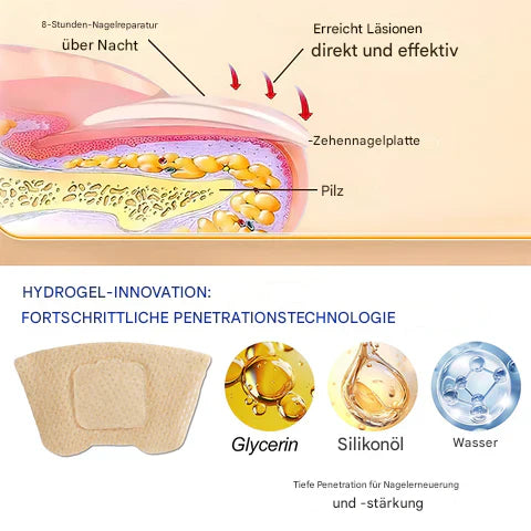 Nailox™ – Für klare, gesunde Nägel mit diskreter Pflege den ganzen Tag lang [1 + 1 Gratis]