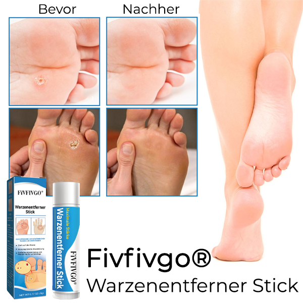 1+1 Gratis | Fivfivgo™ - Schnelle Warzenentfernung