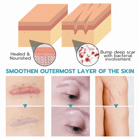 NuSkin™ – Silikon-Faltenpads für Stirn, Augen- und Lachfältchen effektiv [50% Rabatt]