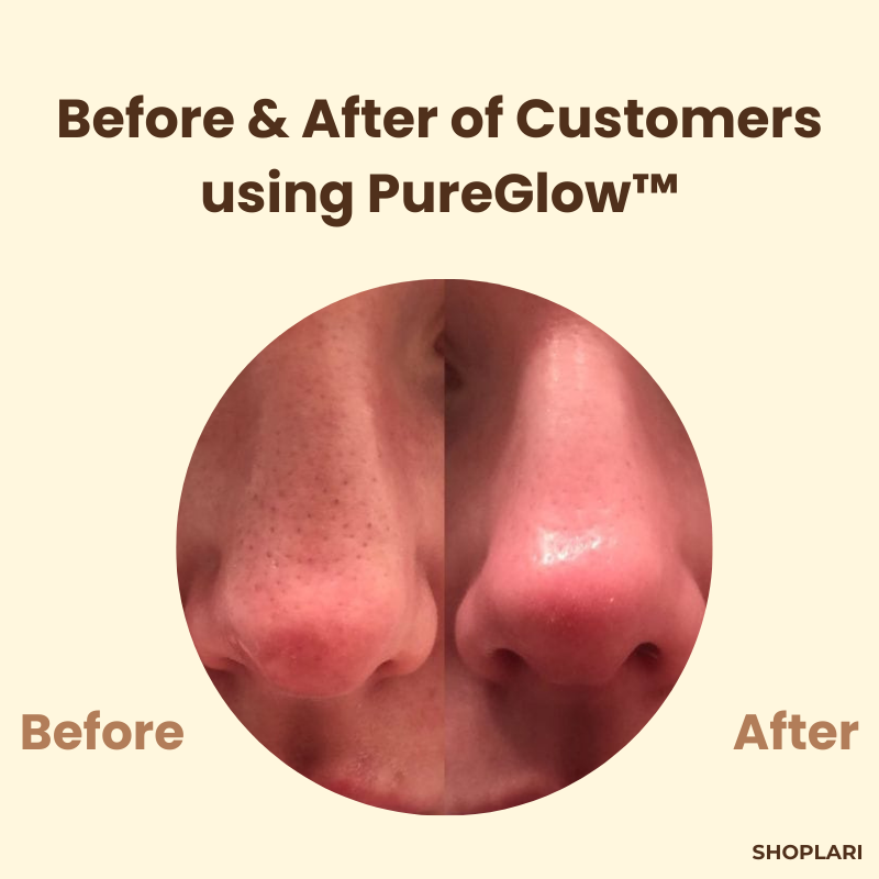 PureGlow™ – Klare, jugendliche Haut, die Selbstvertrauen ausstrahlt [1 + 1 Gratis]