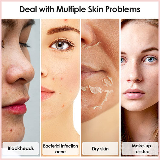 GlowPure™ – Sanftes Gesichtsreinigungsgerät für strahlende, gepflegte Haut [50% Rabatt]