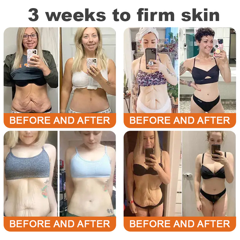 TLopa™ – Strafft Haut & reduziert Falten mit Hyaluron & Peptiden, für Gesicht & Körper [1 + 1 Gratis]