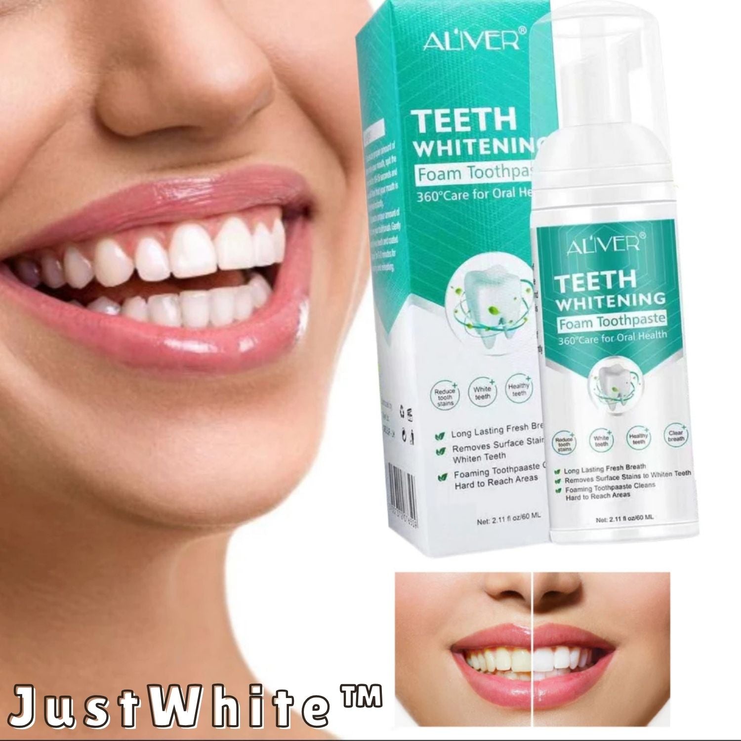 JustWhite™ – Entfernt Flecken & Aufhellend, Frischer Atem & Natürlich Sicher [1 + 1 Gratis]